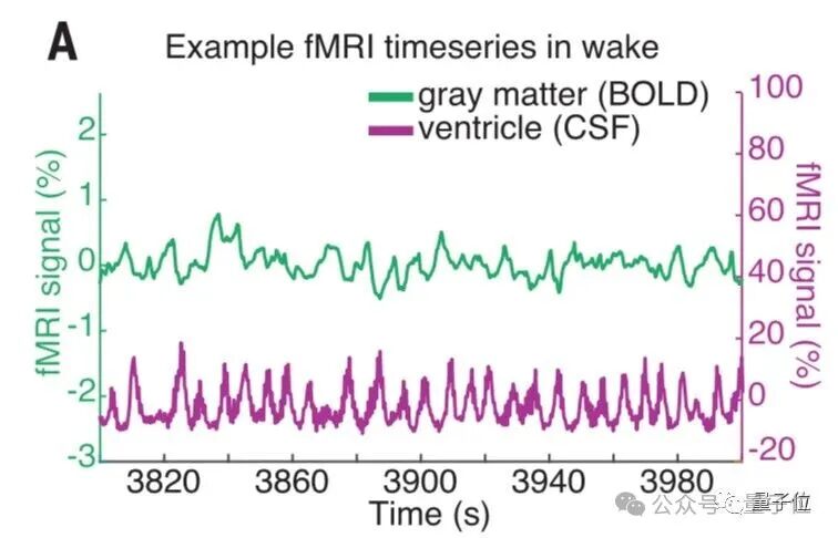 熬夜后走神不是你的错,而是自救机制在“洗脑” | Nature 熬夜后走神不是你的错,而是自救机制在“洗脑” | Nature
