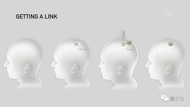 马斯克最新芯片：脑机专用，让失明人群“看见”