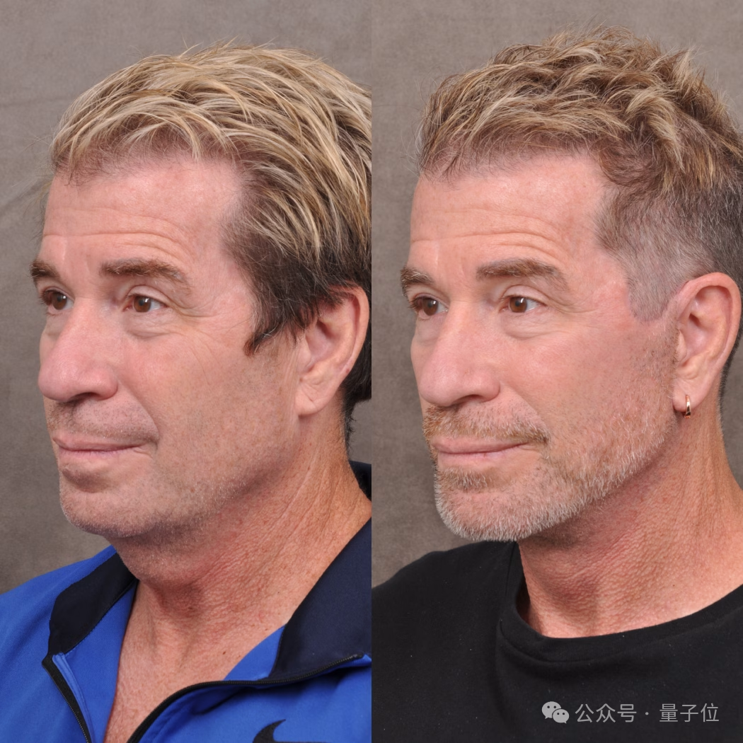 硅谷祛眼袋,海淀求嫩肤:中外科技老哥都在偷偷卷颜值 硅谷祛眼袋,海淀求嫩肤:中外科技老哥都在偷偷卷颜值