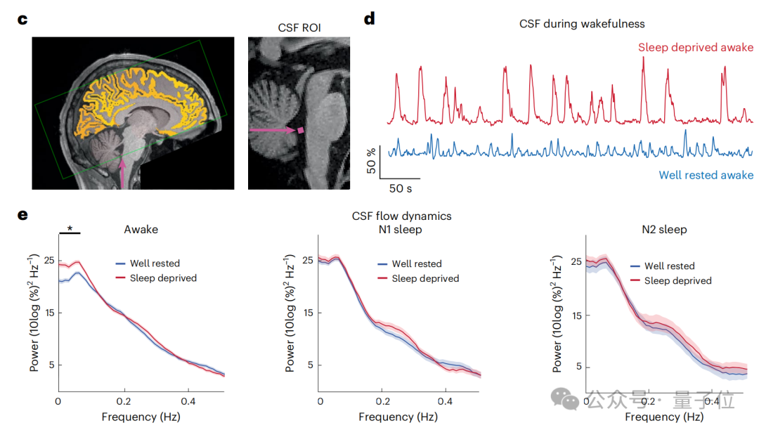 熬夜后走神不是你的错,而是自救机制在“洗脑” | Nature 熬夜后走神不是你的错,而是自救机制在“洗脑” | Nature